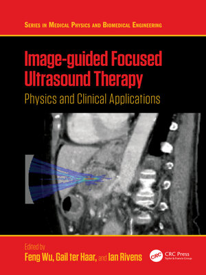 cover image of Image-guided Focused Ultrasound Therapy